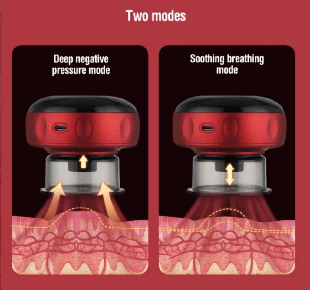 Intelligent Cupping Machine – DB Fitness & Injury Clinic